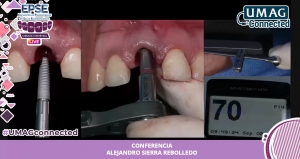 EPSE 2020 LIVE CIRUG&Iacute;A Y EST&Eacute;TICA